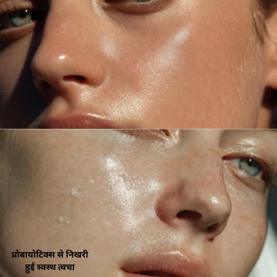 प्रोबायोटिक्स से निखरी हुई स्वस्थ त्वचा